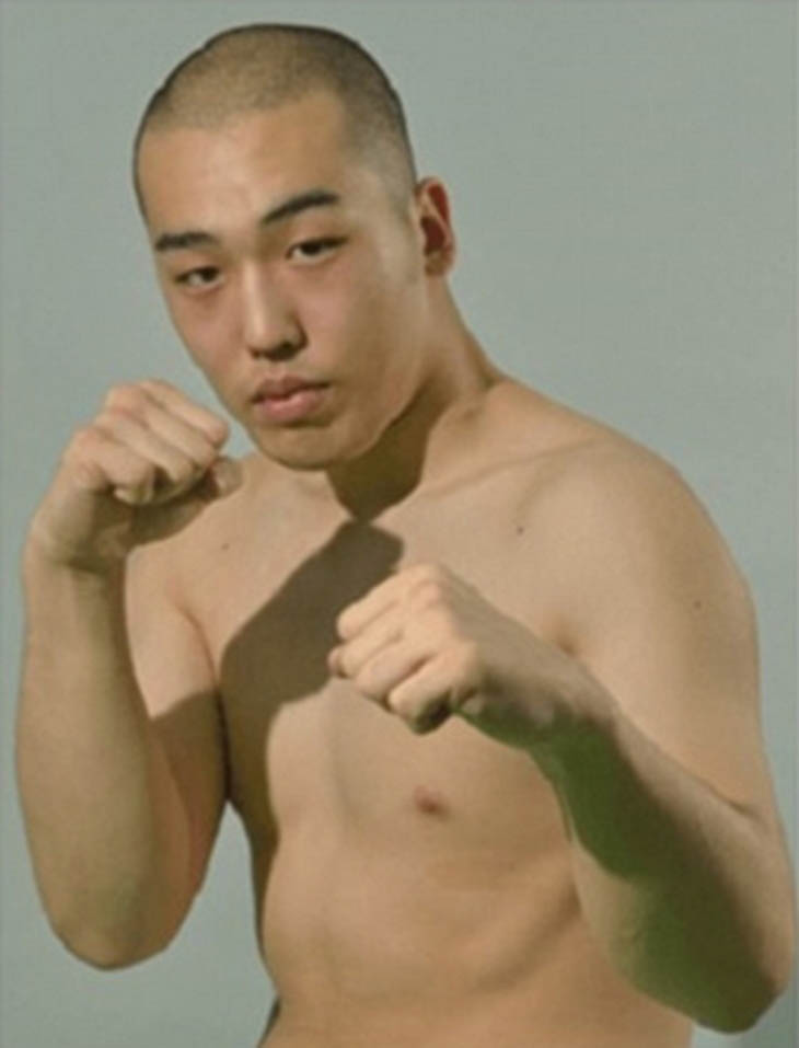 Nhật Bản: Nạn nhân bị cắt mất "của quý" xin lỗi thủ phạm Nhật Bản: Nạn nhân bị cắt mất "của quý" xin lỗi thủ phạm